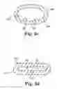 Fig. 04 - Implantable cerebrospinal fluid flow device and method of controlling flow of cerebrospinal fluid