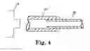Fig. 06 - Implantable cerebrospinal fluid flow device and method of controlling flow of cerebrospinal fluid
