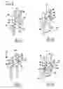 Fig. 05 - Latching blocking mechanisms and safety medical needle assemblies