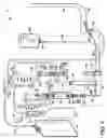 Fig. 03 - Pneumatically-operated thrombectomy catheter deployment system