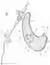 Fig. 02 - Anchoring System for a Medical Article