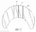 Fig. 05 - Anchoring System for a Medical Article