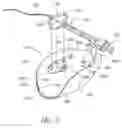 Fig. 07 - Anchoring System for a Medical Article