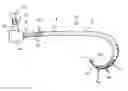 Fig. 01 - Catheter with polymeric coating