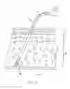 Fig. 03 - Catheter with polymeric coating