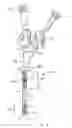 Fig. 04 - Catheter with polymeric coating