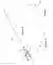Fig. 06 - METHOD AND APPARATUS FOR ULTRAFILTRATION UTILIZING A PERIPHERAL ACCESS DUAL LUMEN VENOUS CANNULA