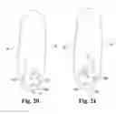 Fig. 14 - Systems and techniques for minimally invasive gastrointestinal procedures