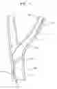 Fig. 02 - Tapered multi-chamber balloon