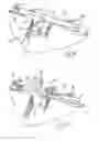 Fig. 12 - Embolic protection system