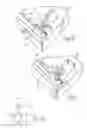 Fig. 14 - Embolic protection system