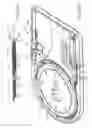 Fig. 16 - Embolic protection system