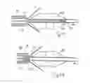Fig. 24 - Embolic protection system