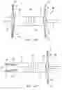 Fig. 56 - Clip-based systems and methods for treating septal defects