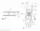 Fig. 01 - Clip-Based Systems and Methods for Treating Septal Defects