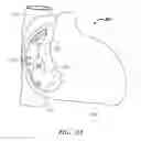 Fig. 03 - Clip-Based Systems and Methods for Treating Septal Defects