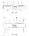 Fig. 33 - Clip-Based Systems and Methods for Treating Septal Defects