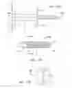 Fig. 53 - Clip-Based Systems and Methods for Treating Septal Defects
