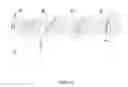 Fig. 04 - Cochlear implant fitting