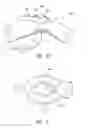 Fig. 07 - External wearable light therapy treatment systems