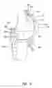 Fig. 09 - External wearable light therapy treatment systems