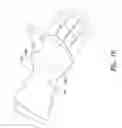 Fig. 16 - External wearable light therapy treatment systems