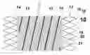 Fig. 01 - Helical stent