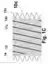 Fig. 04 - Helical stent