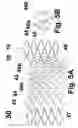 Fig. 11 - Helical stent