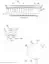 Fig. 03 - Expandable biodegradable polymeric stents for combined mechanical support and pharmacological or radiation therapy