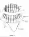 Fig. 06 - Automatic suture fixation apparatus and method for minimally invasive cardiac surgery