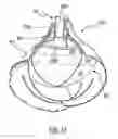 Fig. 09 - Actuator for a heart assist device