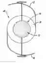 Fig. 01 - Intraocular device