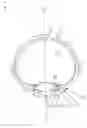 Fig. 02 - Accommodative lens implant, controlled by the ciliary muscle