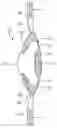 Fig. 01 - Hydrolic accommodating intraocular lens