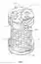 Fig. 02 - End device for a vertebral implant
