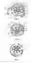 Fig. 03 - End device for a vertebral implant