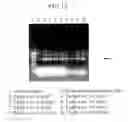 Fig. 13 - METHOD OF PRODUCING TRANSGENIC PLANTS HAVING IMPROVED AMINO ACID COMPOSITION AND IMPROVED YIELDING