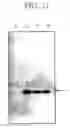 Fig. 16 - METHOD OF PRODUCING TRANSGENIC PLANTS HAVING IMPROVED AMINO ACID COMPOSITION AND IMPROVED YIELDING