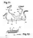 Fig. 06 - Headband device for an oxygen mask