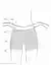 Fig. 01 - Garment with attached shaper