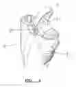 Fig. 05 - Vacuum cleaner