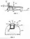 Fig. 06 - Step over walking aid