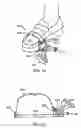 Fig. 22 - Step over walking aid