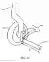 Fig. 33 - Step over walking aid