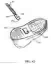 Fig. 34 - Step over walking aid