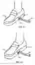 Fig. 03 - Step over walking aid