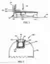 Fig. 06 - Step over walking aid