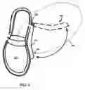 Fig. 11 - Step over walking aid