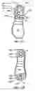 Fig. 14 - Step over walking aid